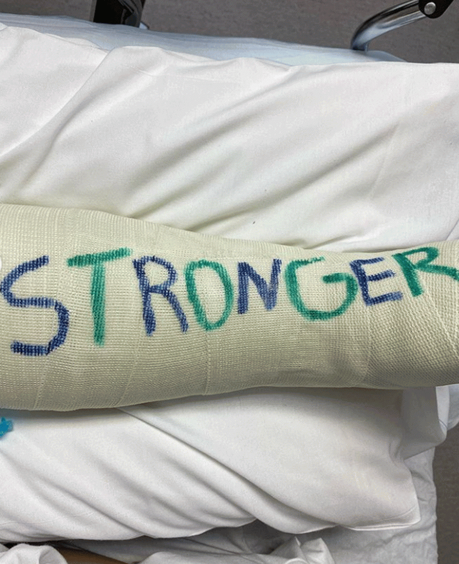 La escayola que le han puesto a Britney Spears porque se ha roto el pie que le llega hasta la rodilla. Su novio, Sam, le ha firmado con la palabra "Stronger", 'más fuerte', como uno de los títulos de sus canciones