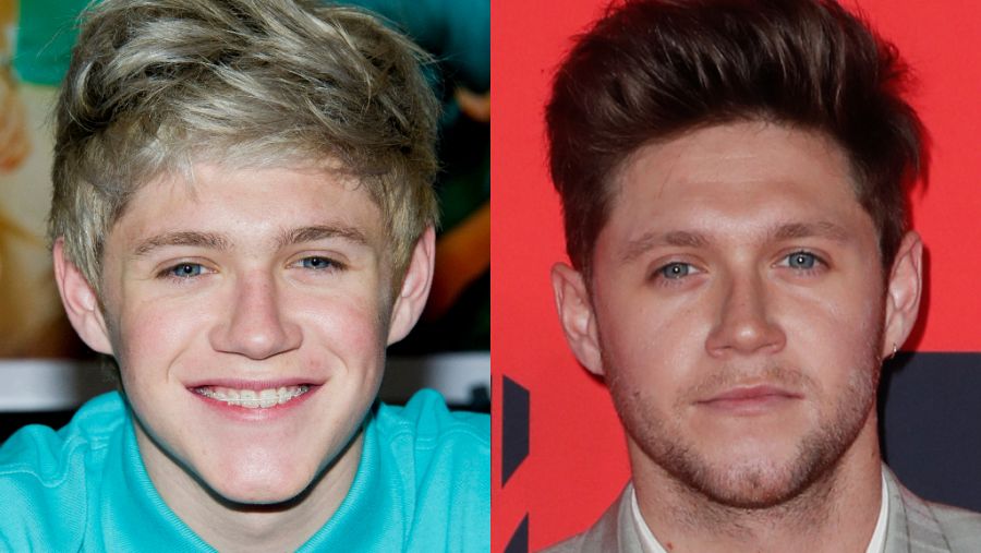 Niall Horan