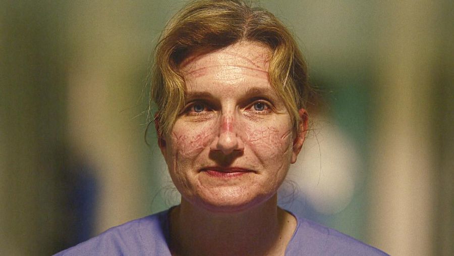 Una de les fotografies de l'exposició "Catalunya any 0. Veure el virus", on la cara d'una infermera reflecteix els efectes de la mascareta.