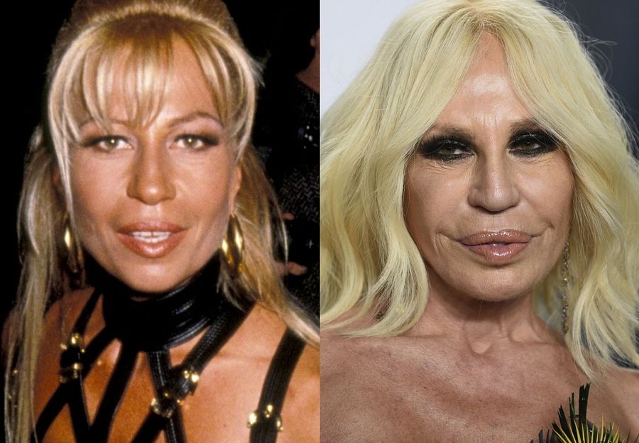 Antes y después de Donatella Versace