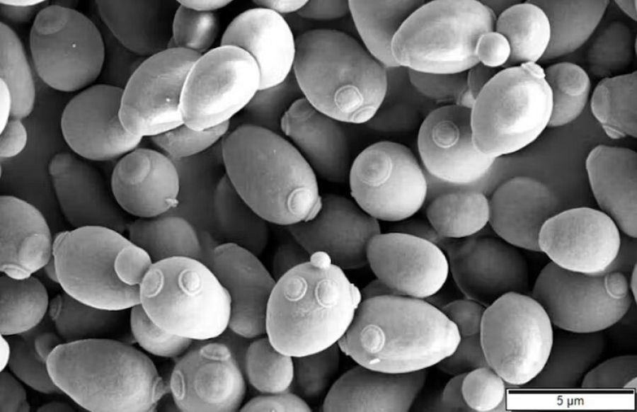 'Saccharomyces cerevisiae'