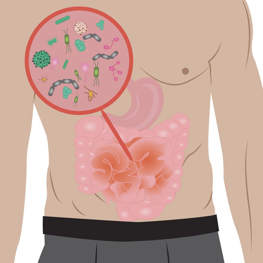 Imagen dolencia intestinal