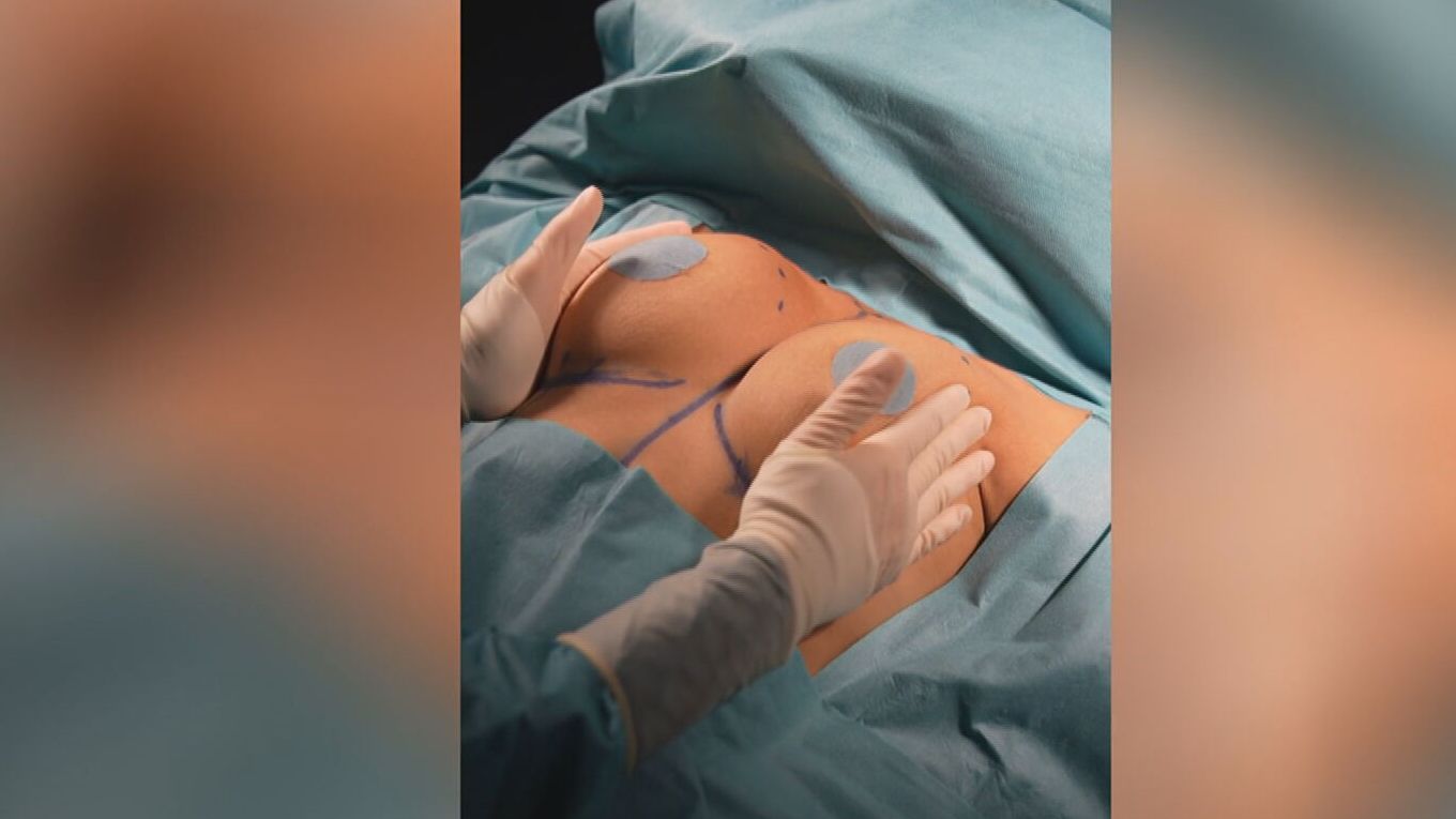 A golpe de bisturí: incremento notable de operaciones estéticas entre las más jóvenes