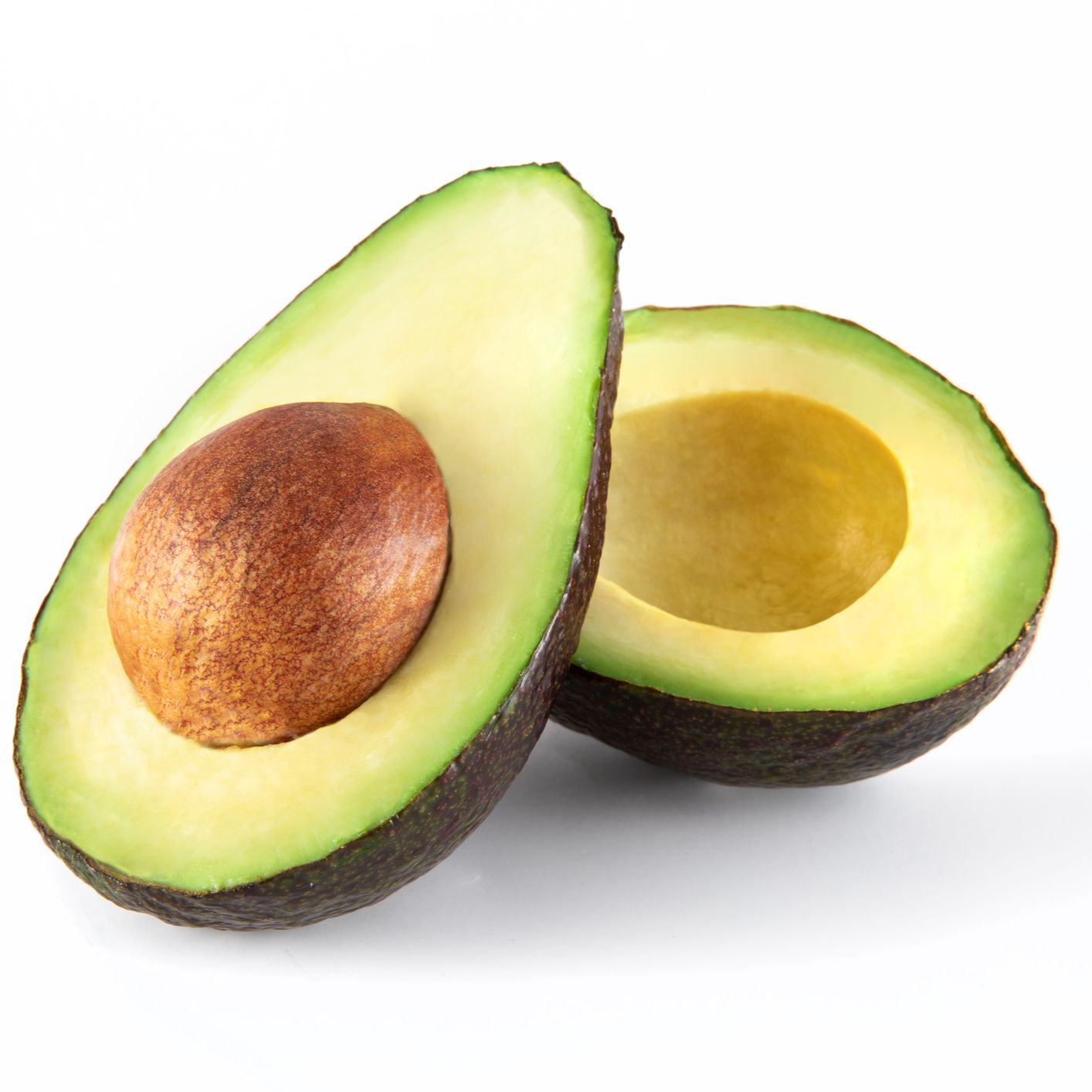 Alimento y salud - El aguacate. S.O.S. rural - 30/03/25