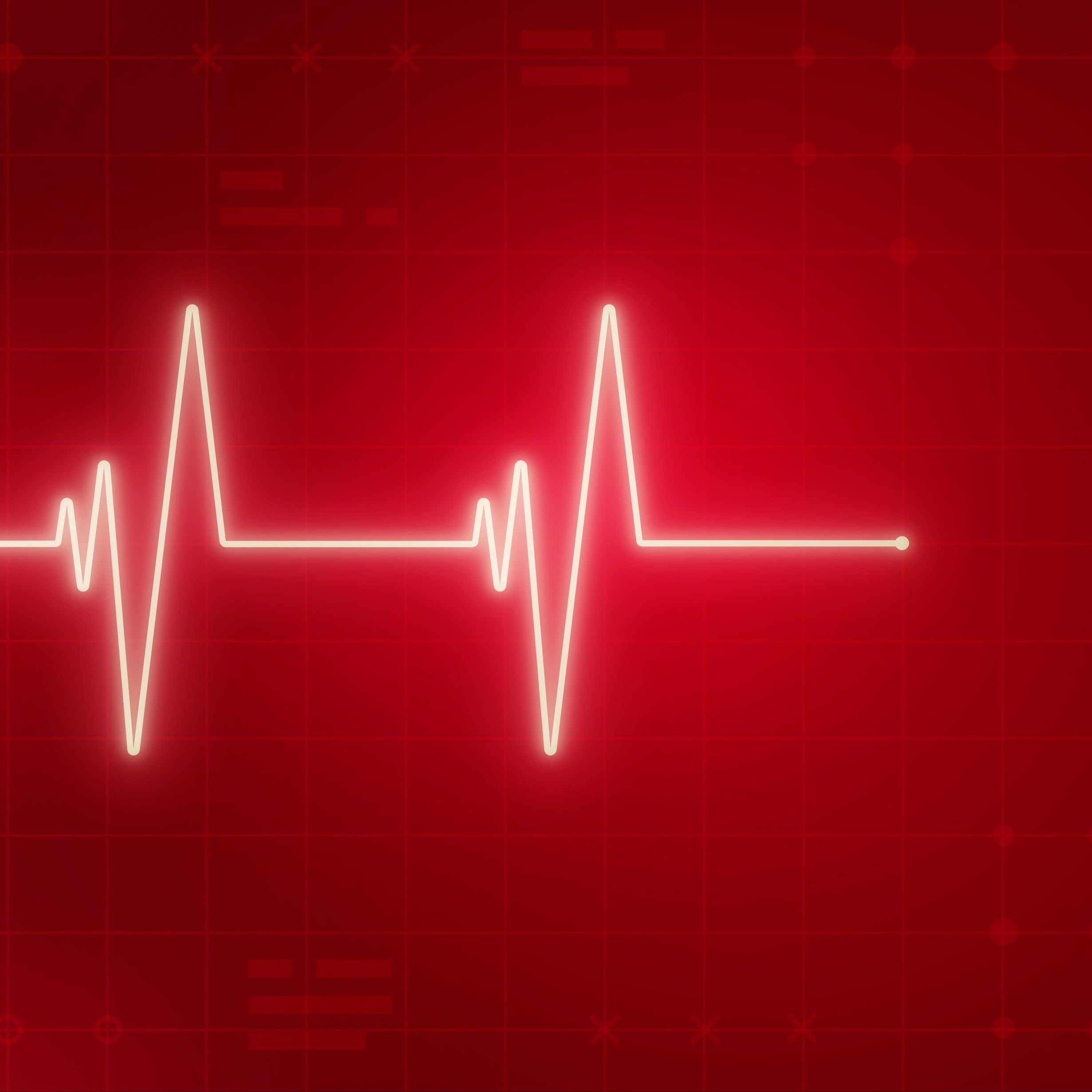 Entre probetas - Avances cardiológicos muy prometedores - 01/04/25 Entre probetas - Avances cardiológicos muy prometedores - 01/04/25