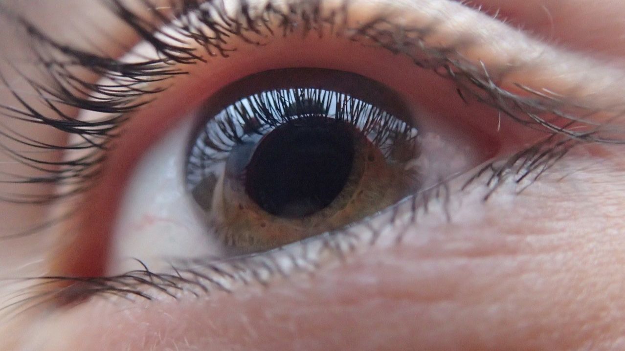 El glaucoma, una ceguesa silenciosa però prevenible episode artwork
