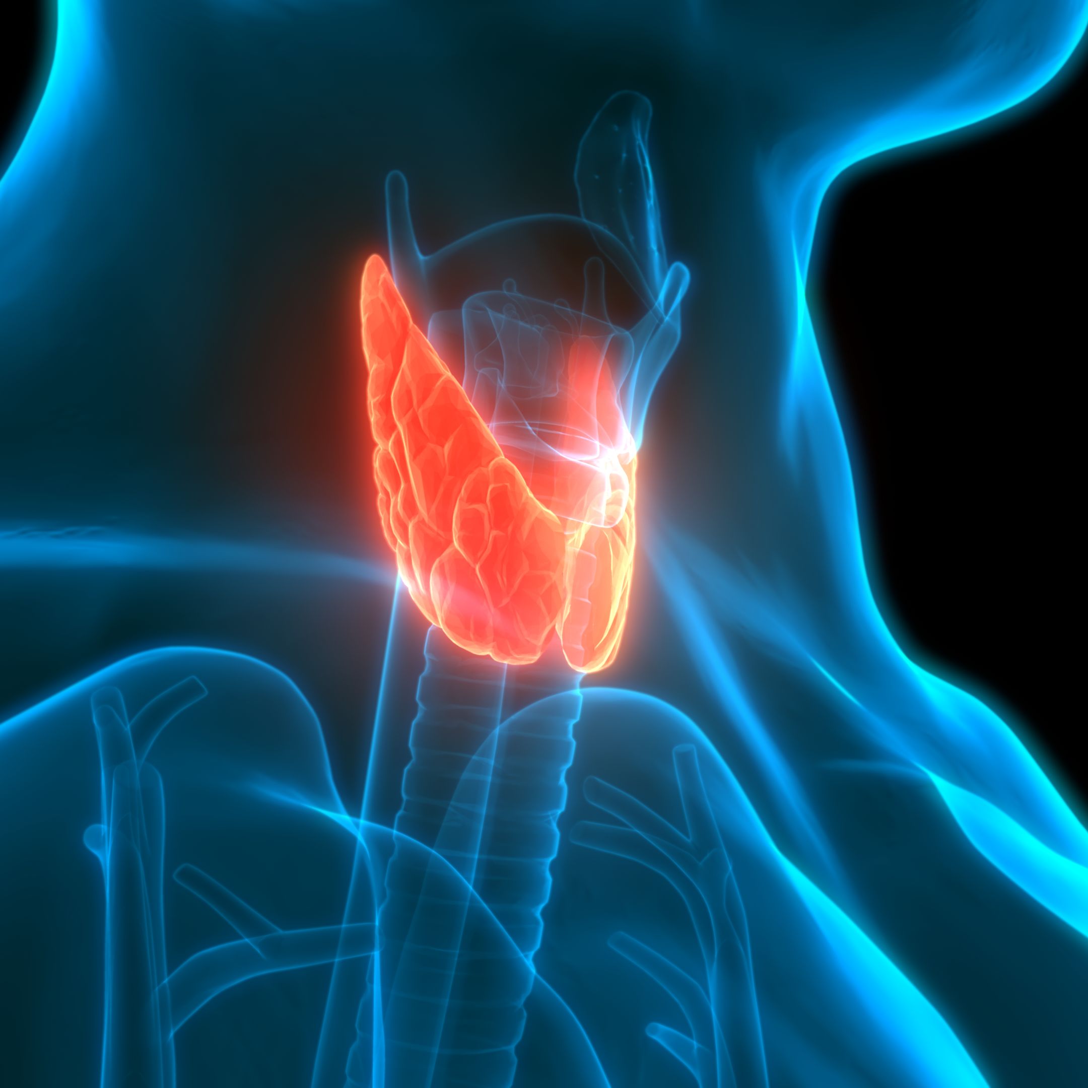 A golpe de bit - Descubierto un acelerador genético del cáncer de tiroides