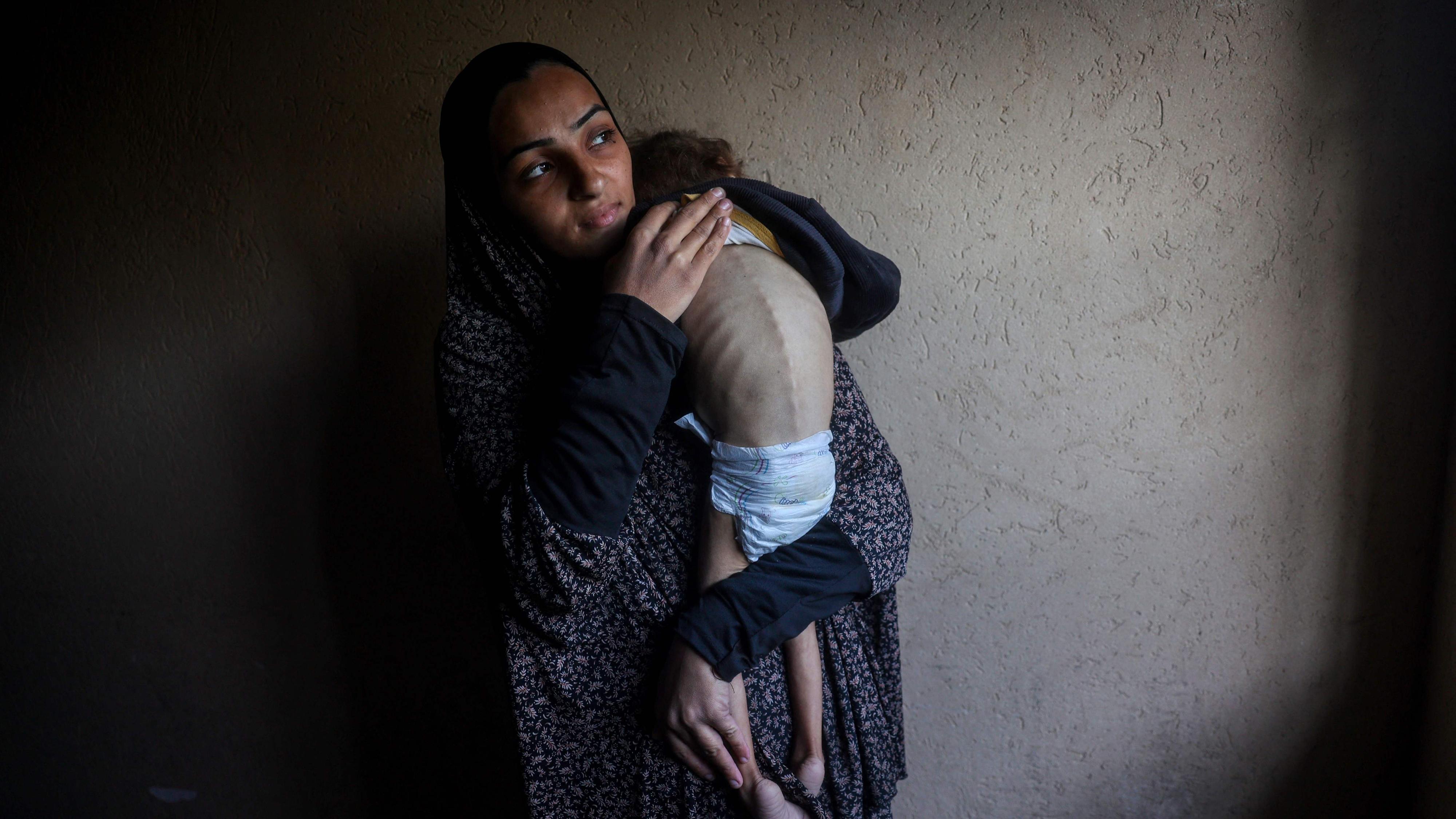 La ONU denuncia que un niño muere cada hora en Gaza por los ataques ...