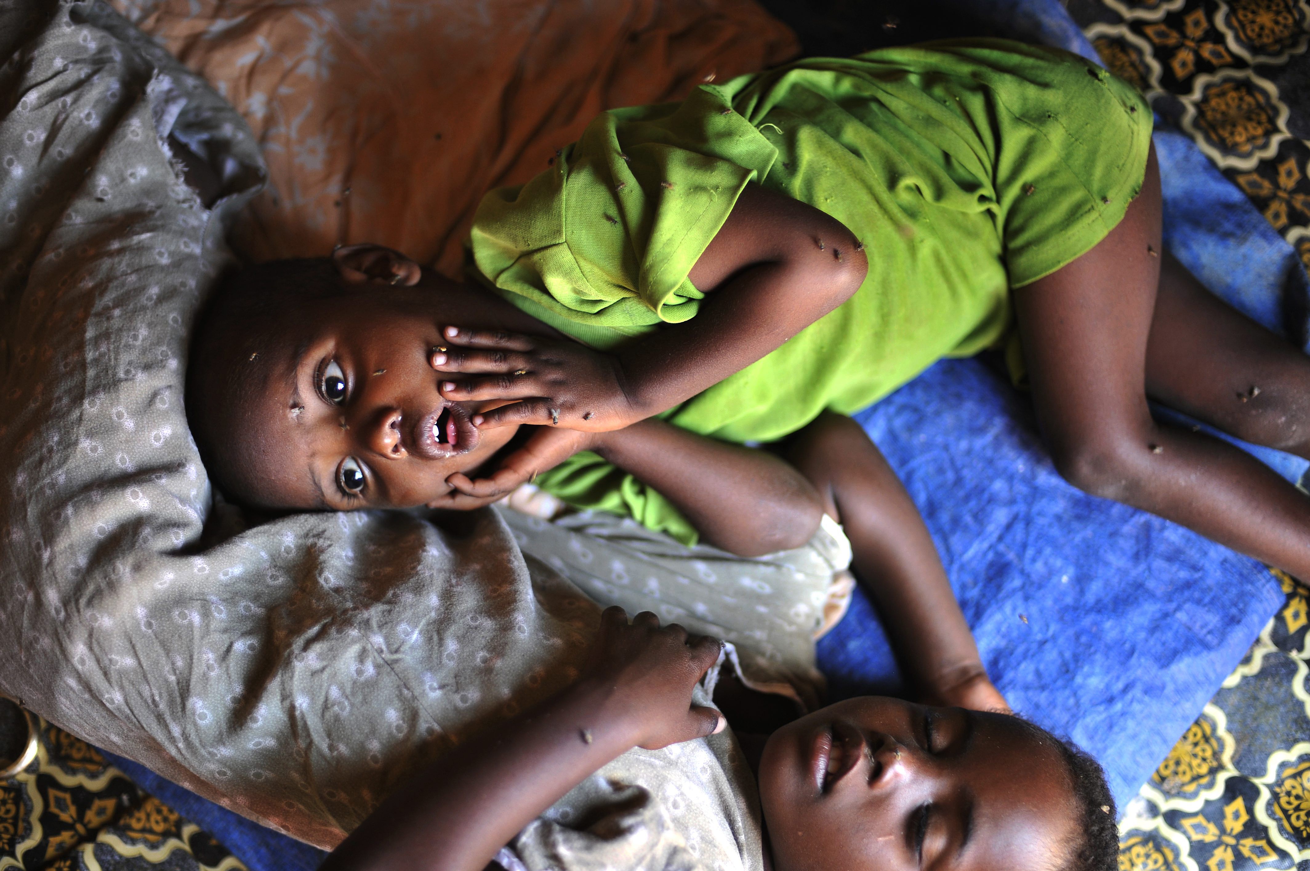 hambre infantil en áfrica