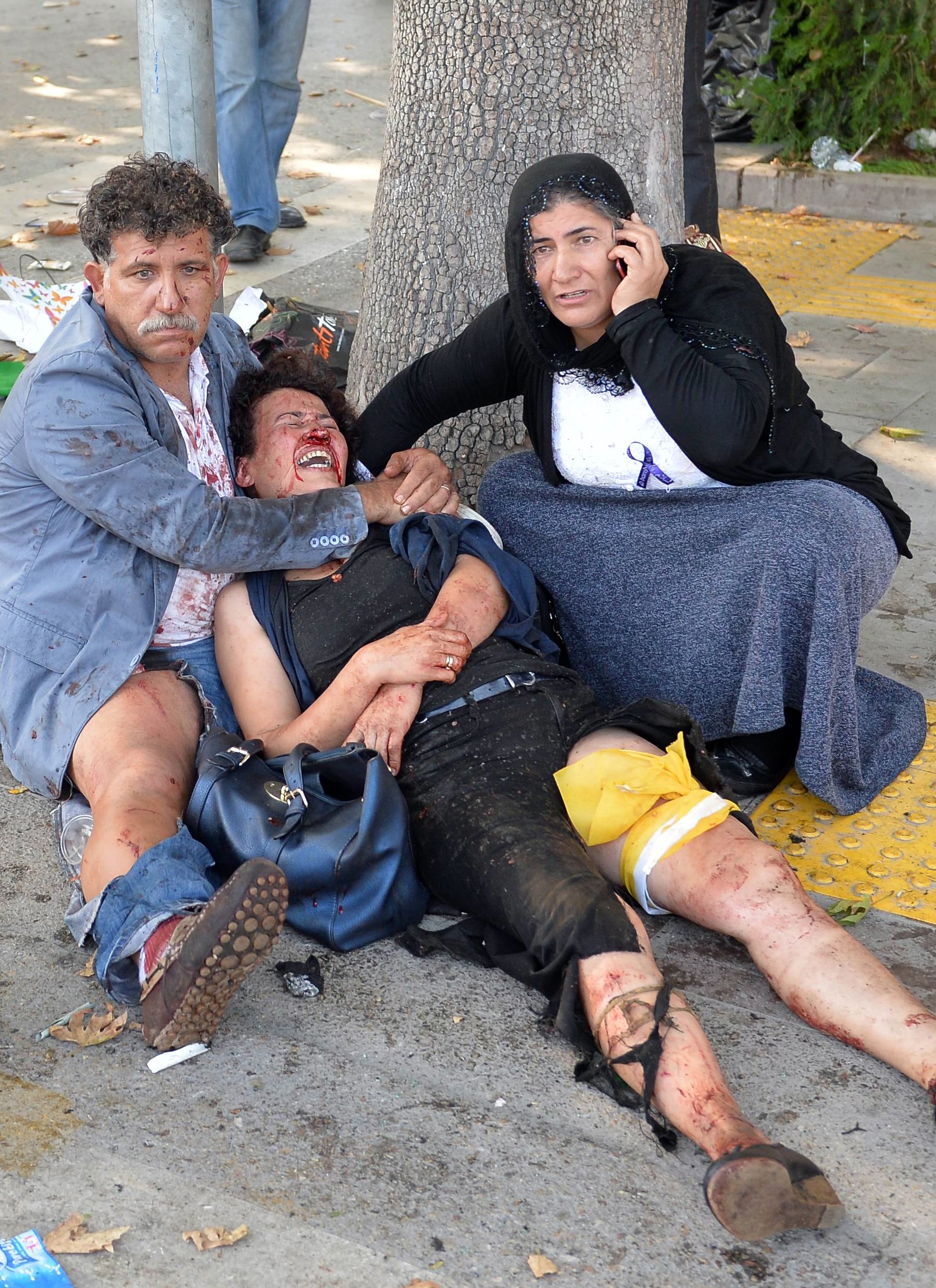 Una de las personas heridas, junto con otros dos manifestantes Una de las personas heridas, junto con otros dos manifestantes