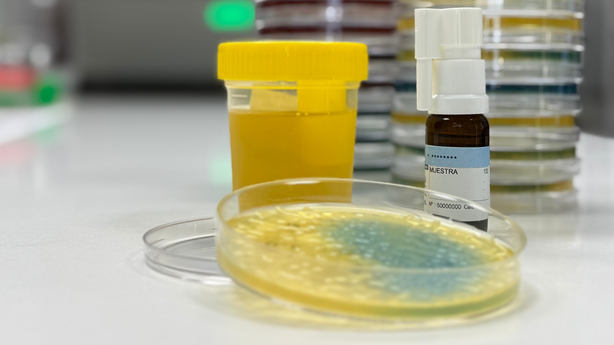 Una vacuna a mida aconsegueix frenar les infeccions d'orina recurrents episode artwork