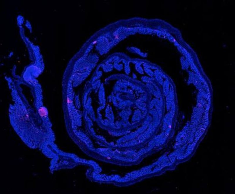 Identifican en ratones dos proteínas implicadas en el cáncer colorrectal