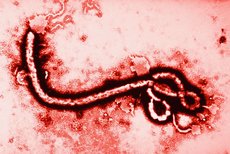 Las vacunas del ébola podrían llegar en enero a África si los ensayos clínicos tienen éxito