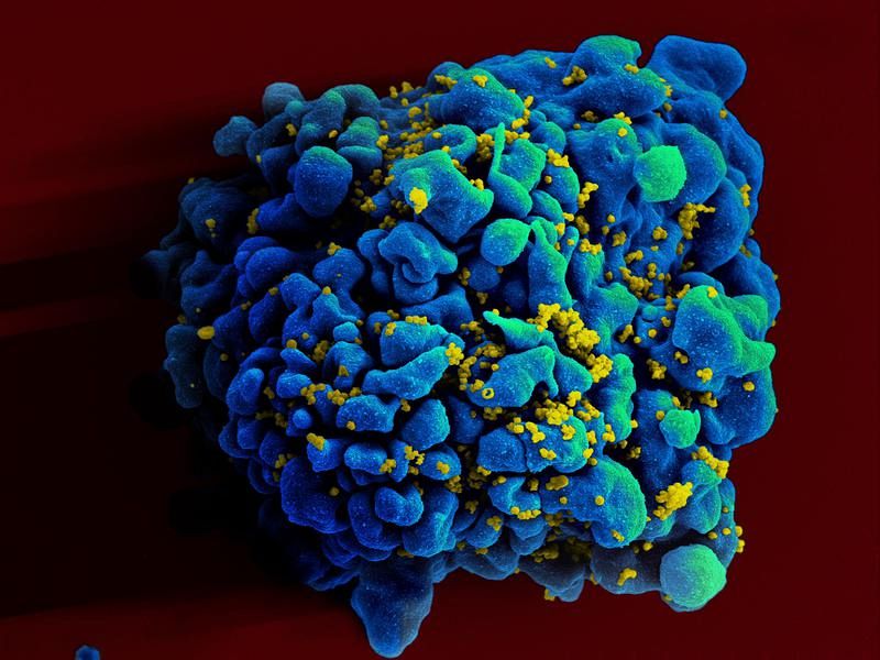 Tratar al mismo tiempo el VIH y la hepatitis C beneficia la lucha contra las dos infecciones