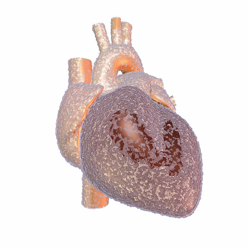 El frío aumenta la presión arterial y el colesterol, según un estudio