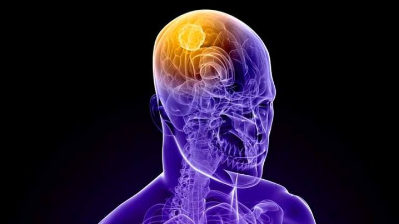 Cosas para comerte el coco