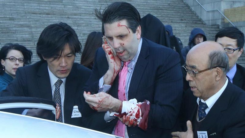 El embajador de EE.UU. en Corea del Sur, atacado con un cuchillo en Seúl