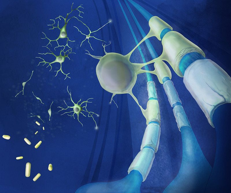 Dos fármacos cutáneos regeneran neuronas dañadas por la esclerosis múltiple