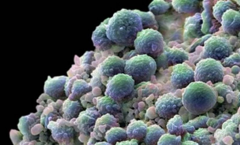 Las biopsias líquidas revelan más mutaciones en tumores que las de tejidos