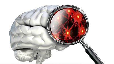 InquietaMENTE - Cerebro espiritual - 08/09/15 - Escuchar ahora