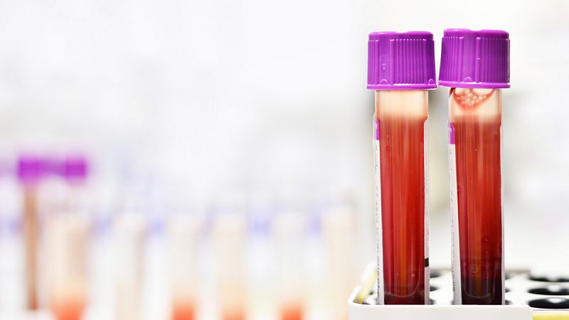 Científicos españoles abren una nueva vía para combatir el desgaste de las células madre sanguíneas
