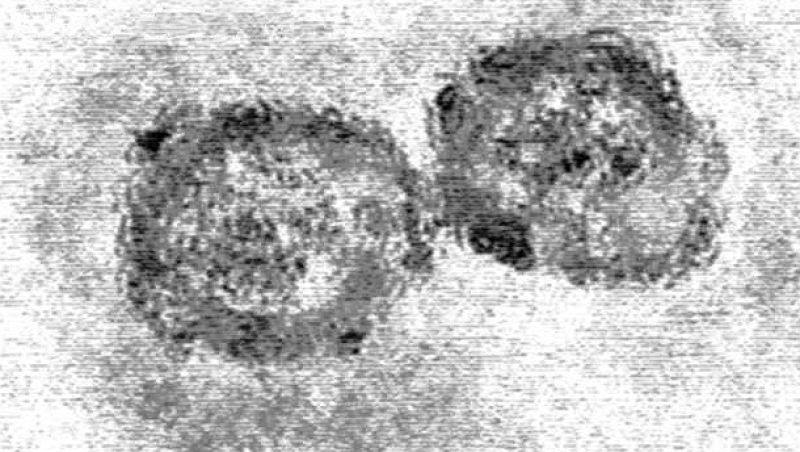 La hepatitis C, contra las cuerdas