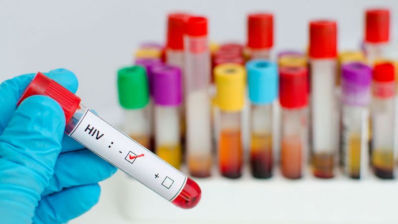 España lidera un ensayo para erradicar el VIH con sangre de cordón umbilical en pacientes oncohematológicos