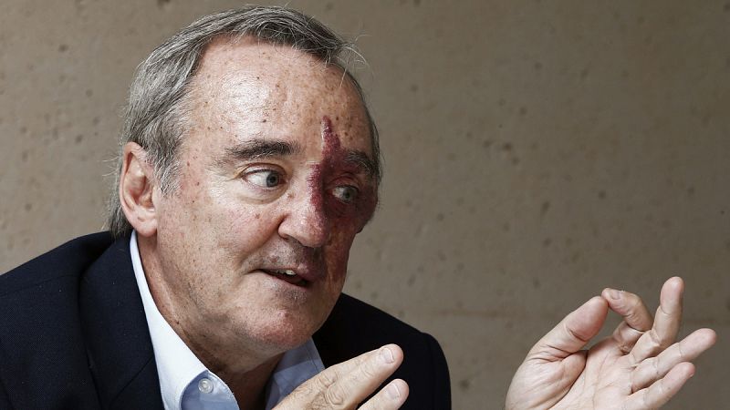 Barbacid: "Contra el cáncer, la investigación en inmunoterapia es cara pero es la mejor opción"