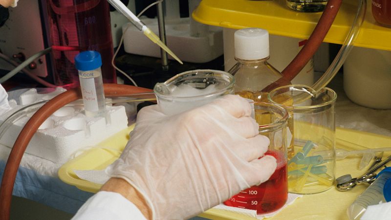 Investigadores japoneses descubren una proteína inhibidora del VIH