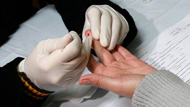 El 46,2% de los diagnosticados de VIH en España en 2014 se detectaron de manera tardía