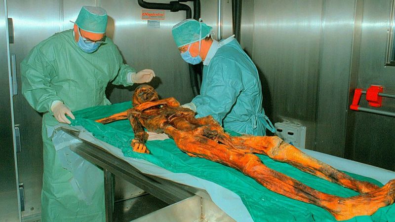 La bacteria helicobacter pylori hallada en el estómago de la momia Ötzi replantea el Neolítico