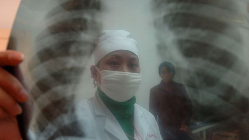 Científicos intentarán llevar medicamentos a las zonas más inaccesibles del pulmón mediante nanotecnología