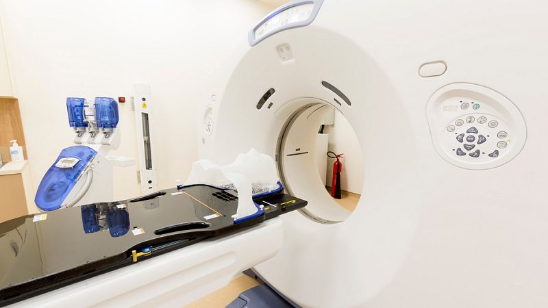 La detección precoz de cáncer de pulmón puede reducir hasta un 20% su mortalidad
