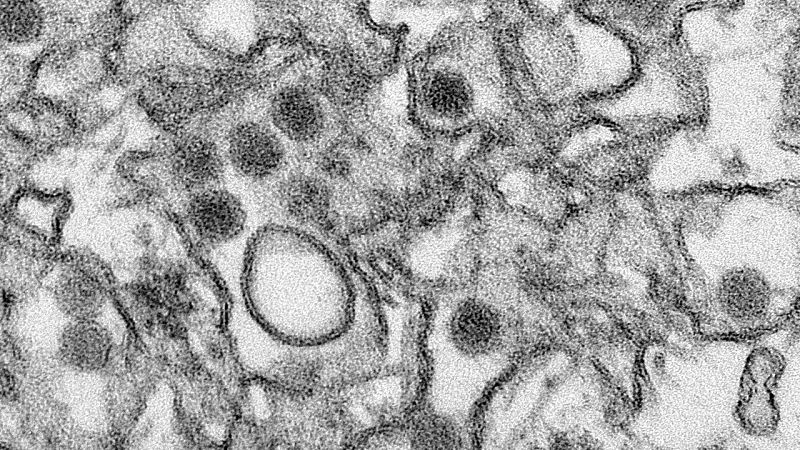 Estados Unidos confirma su primer caso de contagio del virus del Zika