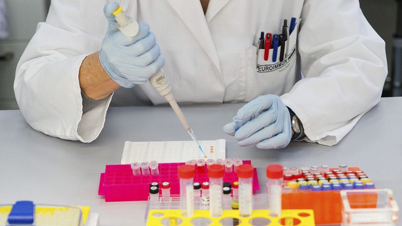 Brasil detecta el virus del Zika en orina y saliva e investiga si pueden transmitirlo