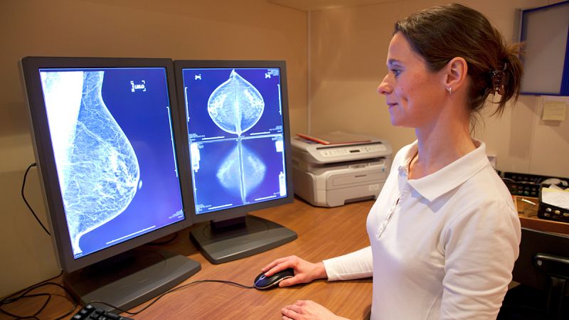 Investigan un test para detectar el cáncer de mama a través de una muestra de sangre