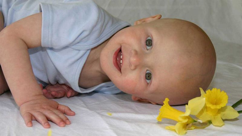 En España se diagnostican 1.200 casos de cáncer infantil al año, de los que se curan cerca del 75%
