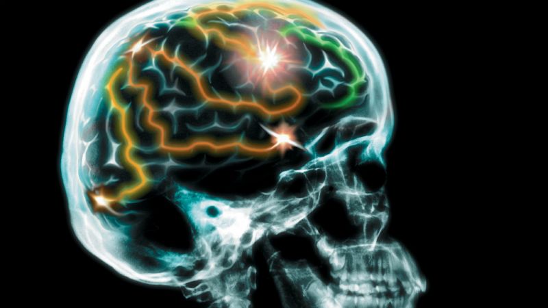 Nuevo test para la detección precoz de la demencia frontotemporal