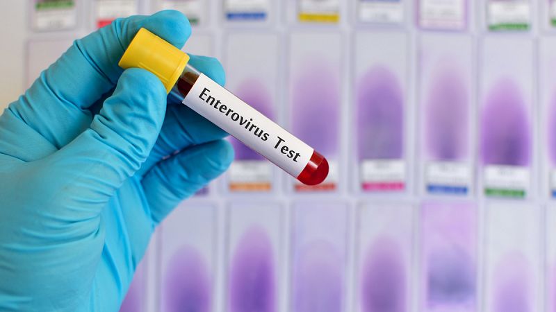 ¿Qué es el enterovirus y cómo se contagia?