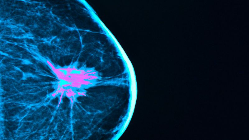 Identifican en ratones la llave molecular que las células del cáncer de mama usan para invadir los huesos