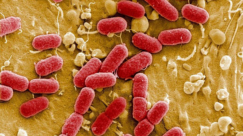 Gran preocupación en EE.UU. ante el primer caso de una bacteria que resiste a los antibióticos más potentes