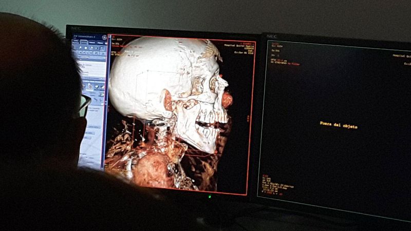 El traslado de las momias del Museo Arqueológico Nacional al hospital en 20 tuits