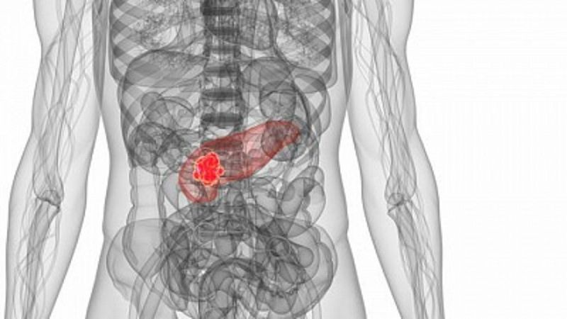 Reducir los niveles de antioxidantes en células tumorales podría conseguir curar el cáncer de páncreas