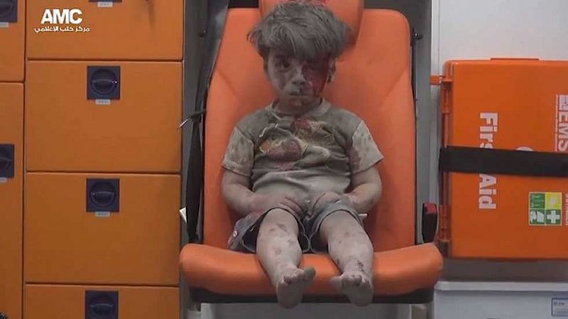 La imagen de un niño herido pone rostro al drama de Alepo