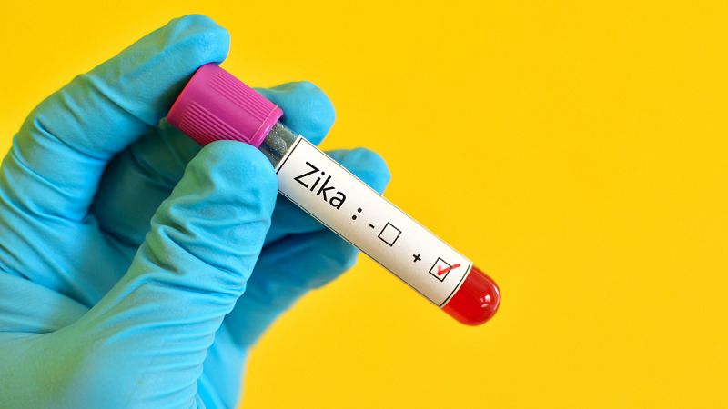 Descubren nuevas pistas sobre cómo el zika afecta al feto