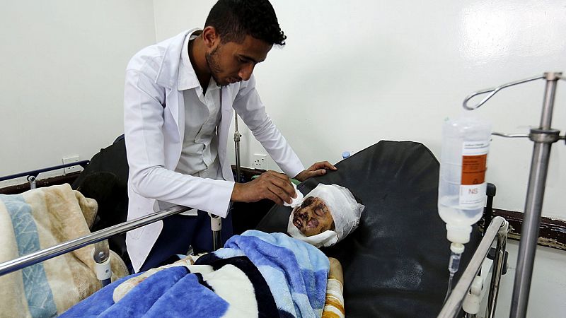 La ONU cifra en 10.000 los muertos en el conflicto yemení