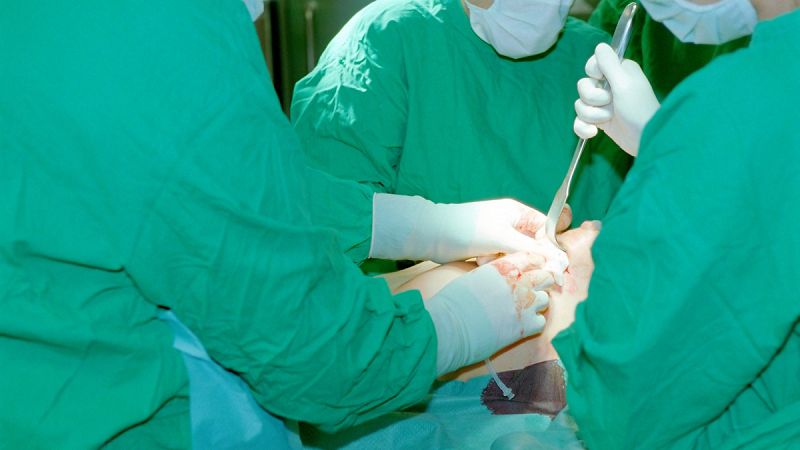 Cirujanos denuncian plazos de hasta cinco años en reconstrucciones de mama tras un cáncer