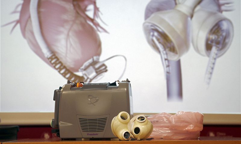 "Este corazón artificial permitirá al paciente llegar a un trasplante cardiaco"