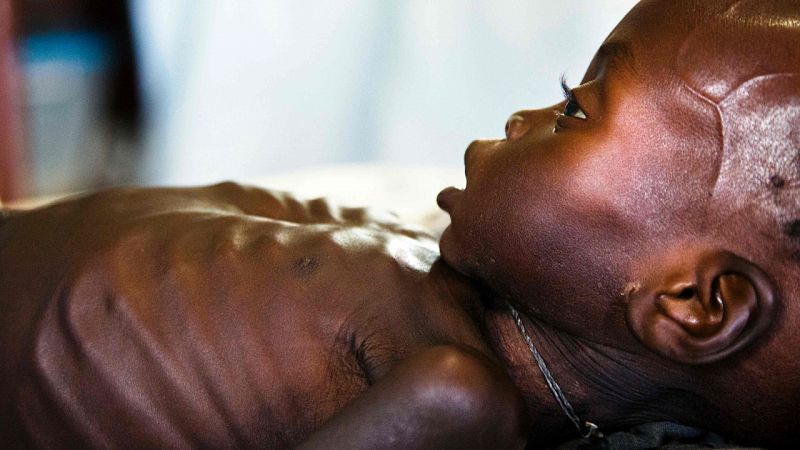 La hambruna afecta a 100.000 personas en Sudán del Sur en su cuarto año de guerra, alerta la ONU