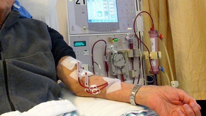 Las enfermedades crónicas de riñón han aumentado un 20% en España durante la última década
